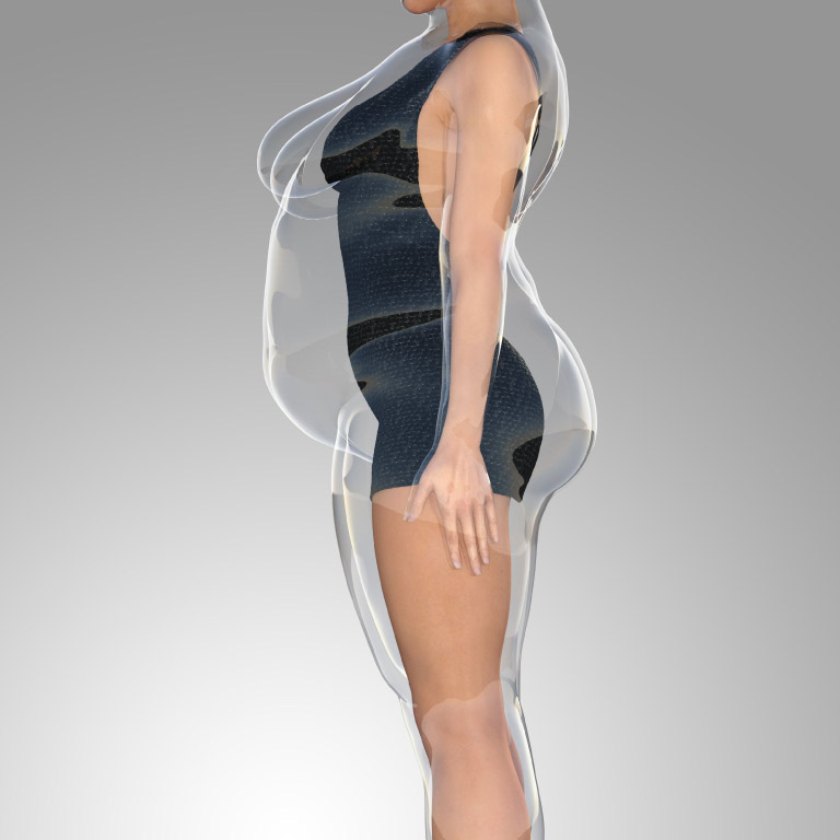 excesso de peso skin boutique
