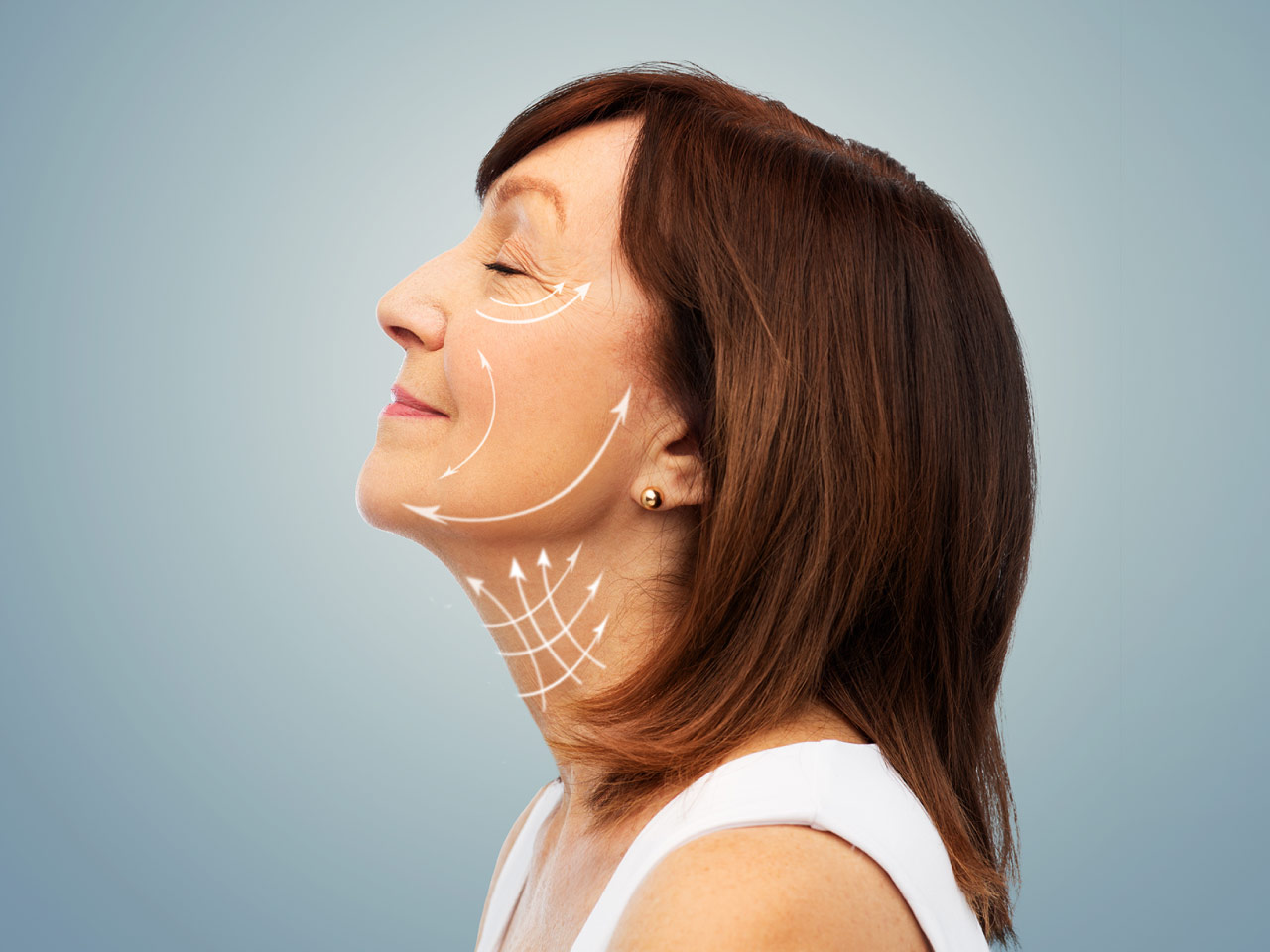 collagen biostimulators