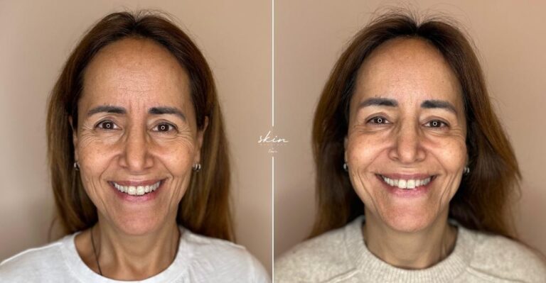 Facial Harmonization #42971_2