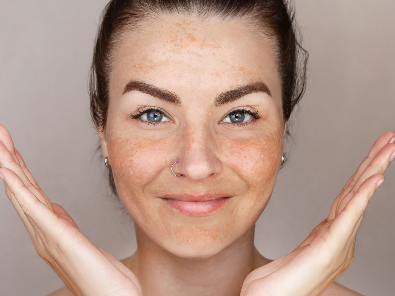 tirar manchas na pele skin boutique