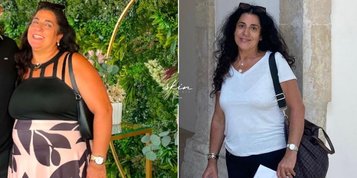 Perda de peso skin boutique