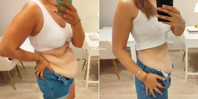 Weight Loss #49840