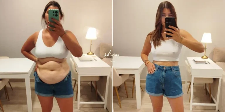 Weight Loss #49840